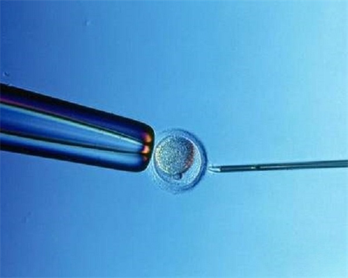 人工授精过程：一次取几个精子？人工授精有几个阶段？