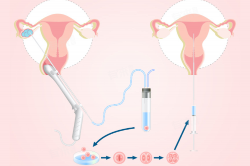 试管受孕双胞胎的危险性：孕期及分娩风险的全面解析