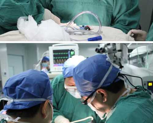 宫腹腔镜与试管婴儿的优劣对比：哪种技术更适合您？