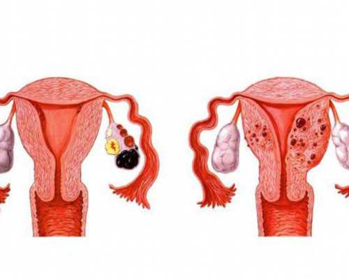 广州冷冻卵子需要多少钱,广州做试管婴儿多少钱